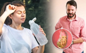 Uống ít nước có làm tăng nguy cơ bị sỏi mật không?