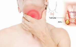 Có những loại bướu tuyến giáp nào?
