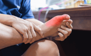 Vì sao người bệnh gout cần chú ý đến sức khỏe tim mạch?