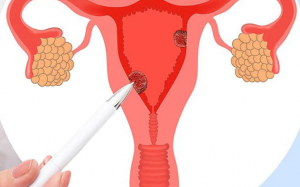 Vì sao PMOS gây thèm đồ ngọt?
