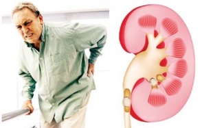 Suy thận mạn ở người cao tuổi: Làm sao để giữ thận khỏe lâu hơn?