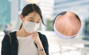 Người lớn cũng bị sởi: Bà bầu cần lưu ý gì?