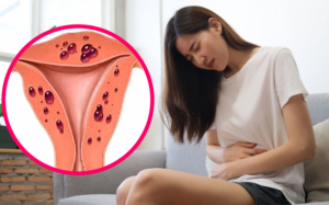 Vì sao lạc nội mạc tử cung thuờng được phát hiện muộn?