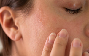 5 nguyên nhân khiến da vẫn khô dù dưỡng ẩm thường xuyên