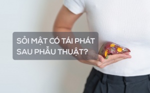 Sỏi mật có tái phát sau phẫu thuật không?