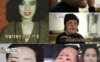 'Méo mó' nhan sắc showbiz Châu Á: Thảm họa phẫu thuật thẩm mỹ