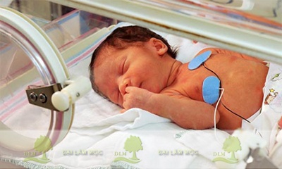 Tỷ lệ trẻ sơ sinh nhẹ cân đang gia tăng