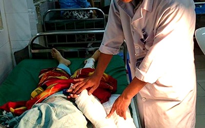 Bàn tay đứt lìa vẫn nối được