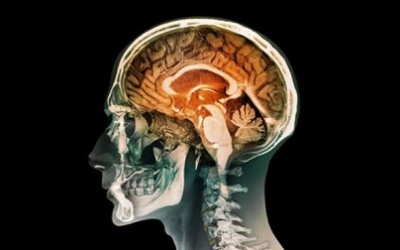 Con người có thể sống nếu thiếu nửa bộ não?