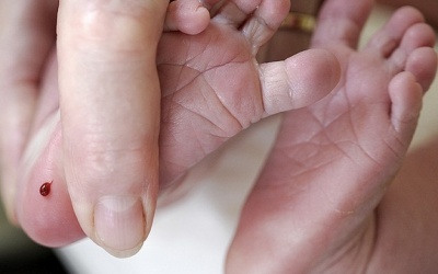 Sàng lọc sơ sinh ở Việt Nam đang được đẩy mạnh 