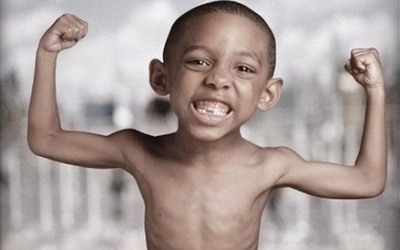 Gần 30% trẻ Việt suy dinh dưỡng thể thấp còi