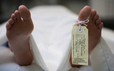 Dùng da người chết để ghép cho người sống