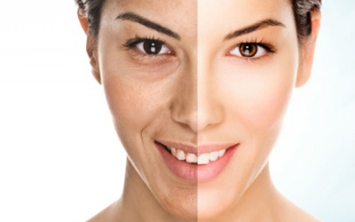 Trẻ đẹp chẳng cần son phấn