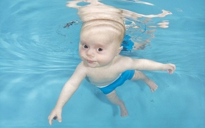 Trẻ sơ sinh tập bơi để phẫu thuật tim