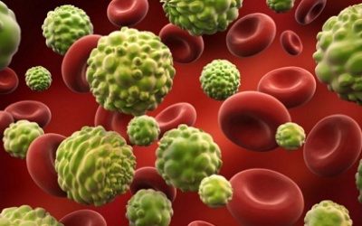 Loại bỏ máu đông điều trị ung thư thận