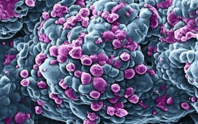 Cơ chế di căn của ung thư