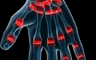 Bẻ khớp ngón tay - Lợi và hại