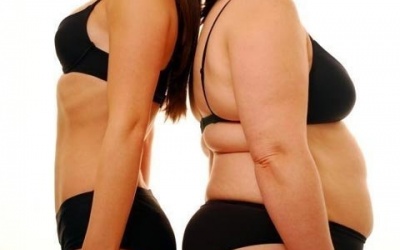 Phụ nữ béo phì: Tăng nguy cơ bị ung thư