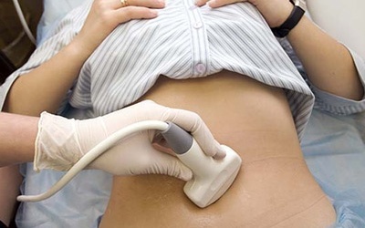 Ung thư buồng trứng: Phát hiện sớm, sống lâu, giảm tái phát