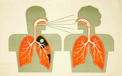 Chẩn đoán lao sớm - Khắc phục khủng hoảng lao đa kháng thuốc