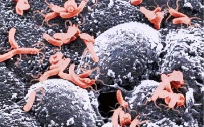 Loét dạ dày vì vi khuẩn HP