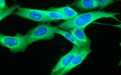 Vaccine hứa hẹn phòng chống ung thư da ác tính tái phát