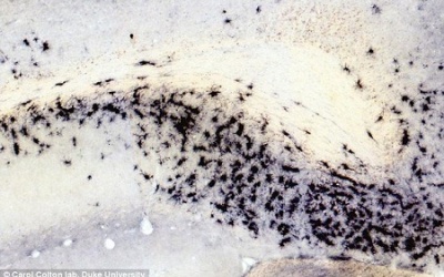 Bổ sung arginase có ngừa được bệnh Alzheimer?
