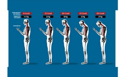 Thoái hóa cột sống vì smart phone