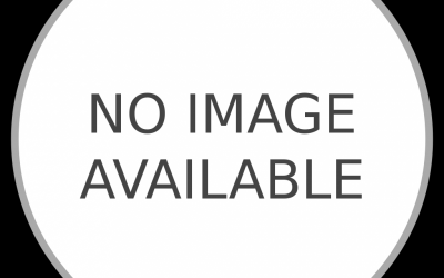 Thiếu nữ xinh đẹp rụng sạch tóc vì căng thẳng khi yêu