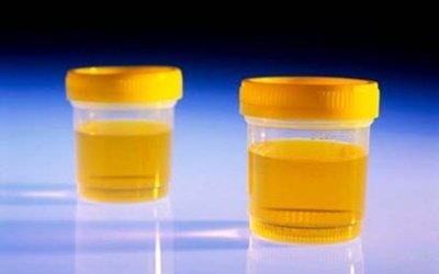 Thiết bị 'ngửi' ung thư