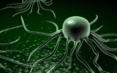 Kỹ thuật phát hiện khối u mới