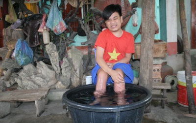 Cậu bé chân nóng như lò than có khả năng chữa khỏi ung thư (?)