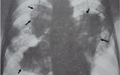 Quần bò Trung Quốc thực sự gây bệnh chết người?