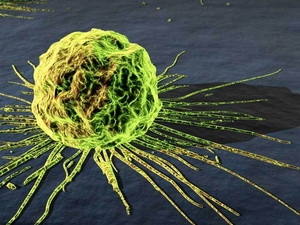 Cuba phát triển một loại thuốc điều trị ung thư mới