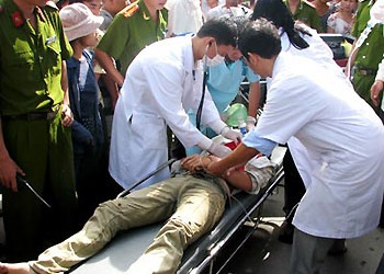 Tai nạn điện giật, phải cắt bỏ chi