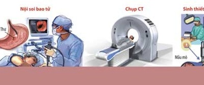 Làm thế nào chẩn đoán bệnh ung thư?