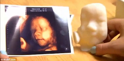 Mô hình thai nhi 3D