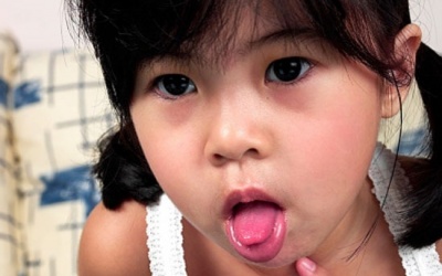 Sơ cứu khi trẻ hóc dị vật