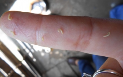 Tiền Giang: Chăm sóc nha khoa bằng cách bắt 'con sâu răng'