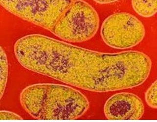 'Chân tướng' vi khuẩn trong các sữa công thức đang bị thu hồi