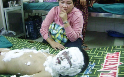 Bé 5 tuổi bị bỏng do nổ tủ điện