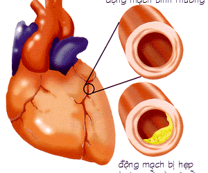Sử dụng TPCN thời gian dài có ảnh hưởng gì không?