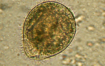 Bệnh hiểm do nhiễm trùng lông