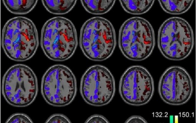 Phát hiện gây shock về người não trái và người não phải