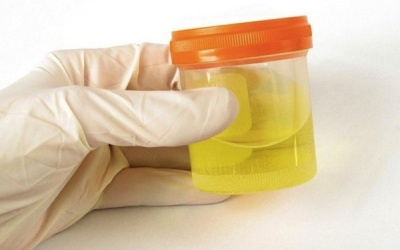 Xét nghiệm nước tiểu cũng bị 'nhân bản'