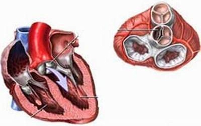 Ích Tâm Khang có thể dùng cho người bị bệnh tim và cao huyết áp không?