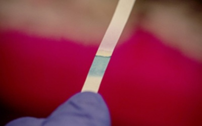 Đoán bệnh cấp tốc nhờ… giấy đổi màu