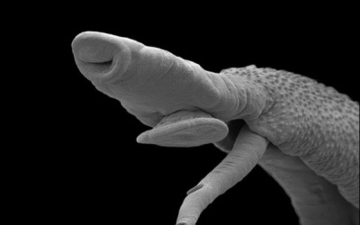 Ký sinh trùng - hung thần ẩn mặt