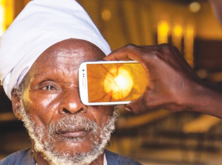 Khám mắt bằng... smart phone