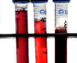 Điều trị ung thư bằng liệu pháp miễn dịch sinh học